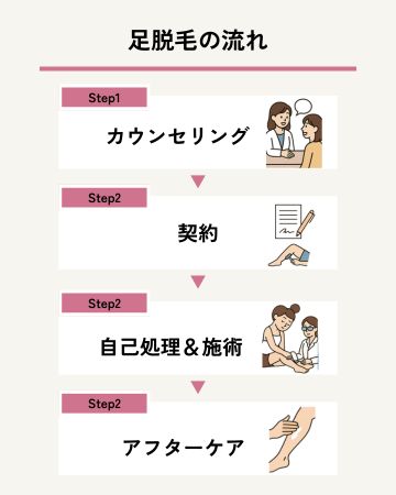 足脱毛を受ける流れ